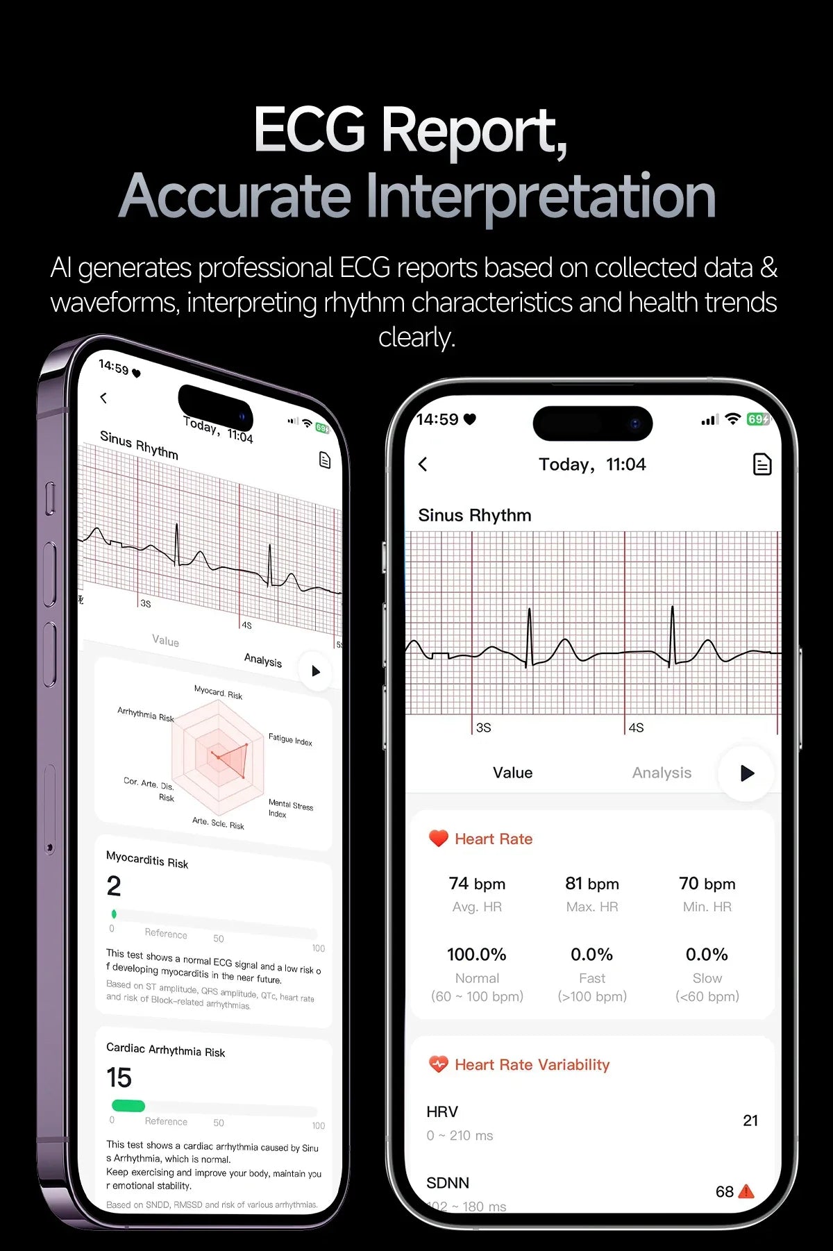 Nuovo Smartwatch 2026 con Analisi del Grasso Corporeo ECG+PPG, Acido Urico, Pressione Sanguigna, Ossigeno nel Sangue, Chiamate Bluetooth, Orologio Sportivo Intelligente per Uomini e Donne