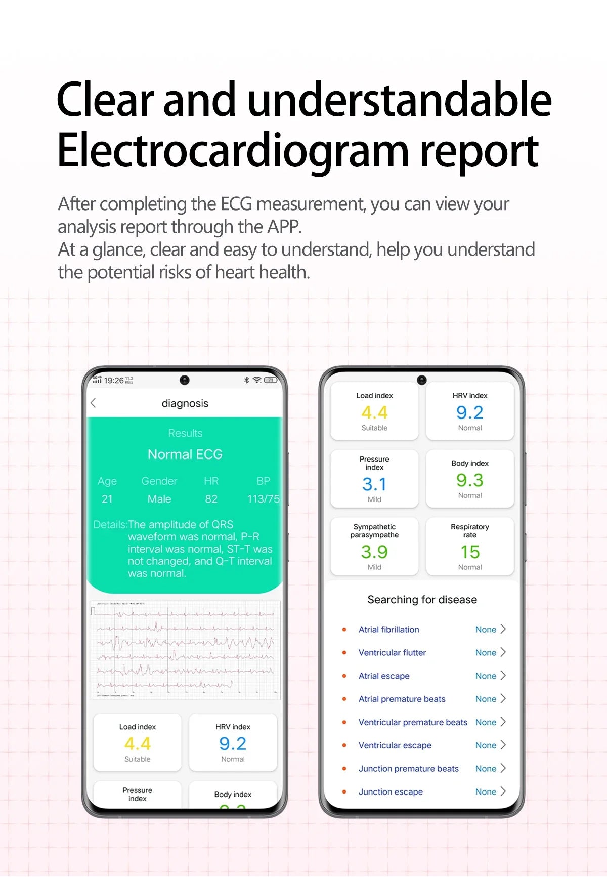 2026 Nuovo aggiornamento AI diagnostico Airbag pressione sanguigna precisa salute SmartWatch acido urico ECG lipidi nel sangue Smartwatch uomo donna