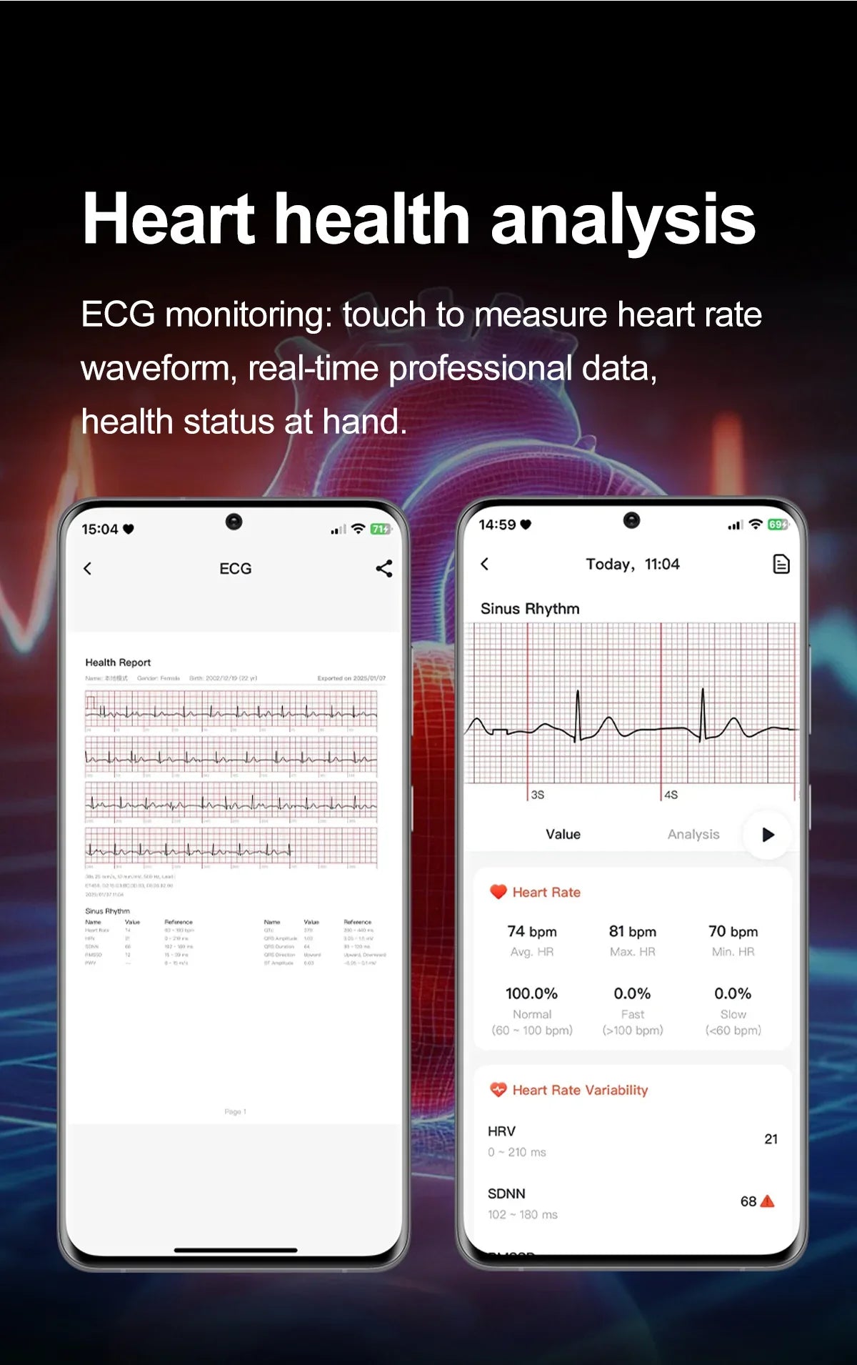 Nuovo Smartwatch 2026 per Analisi del Grasso Corporeo, ECG+PPG, Acido Urico, Pressione Sanguigna, Ossigeno nel Sangue, Orologio con Chiamate per Uomini e Donne